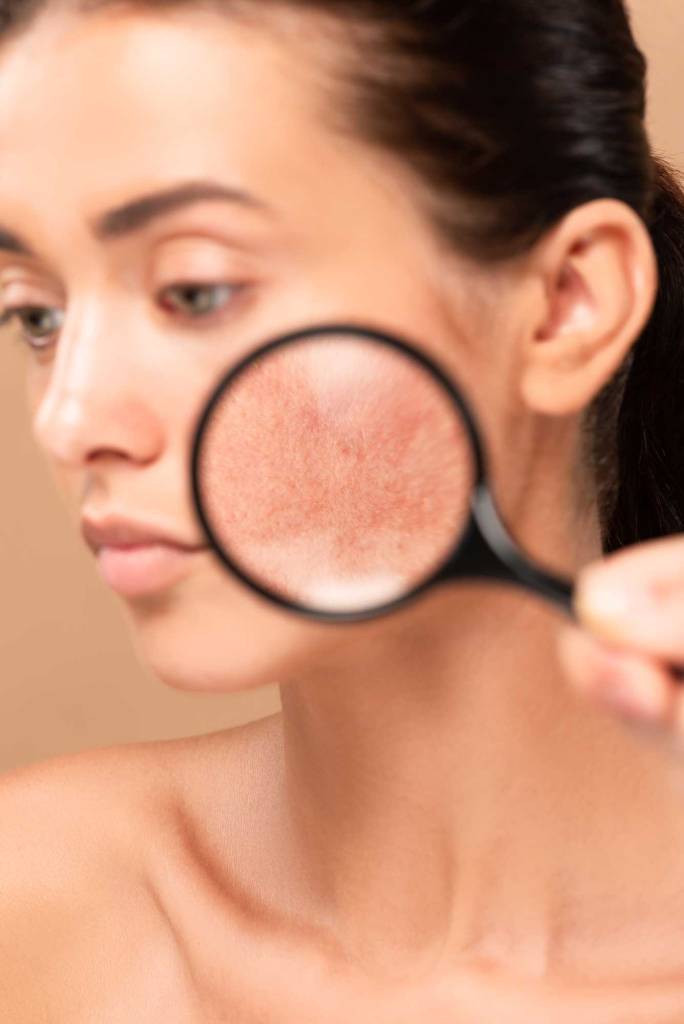 analiza kože in svetovanje pri skincareslo